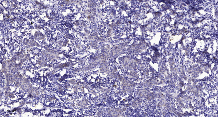 RLF Antibody