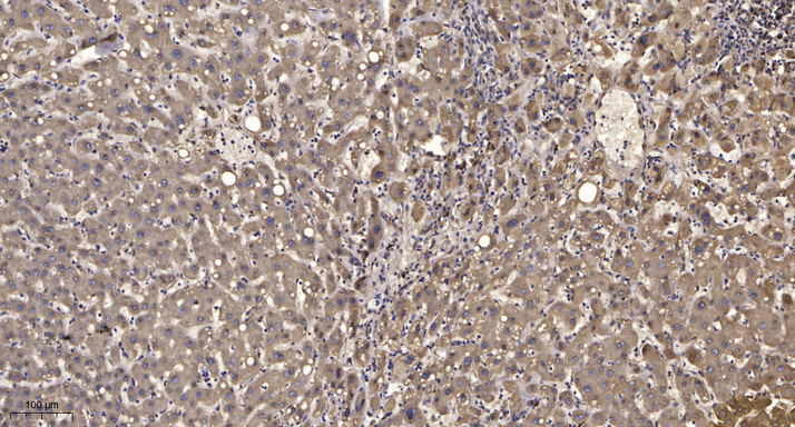 JADE3 Antibody
