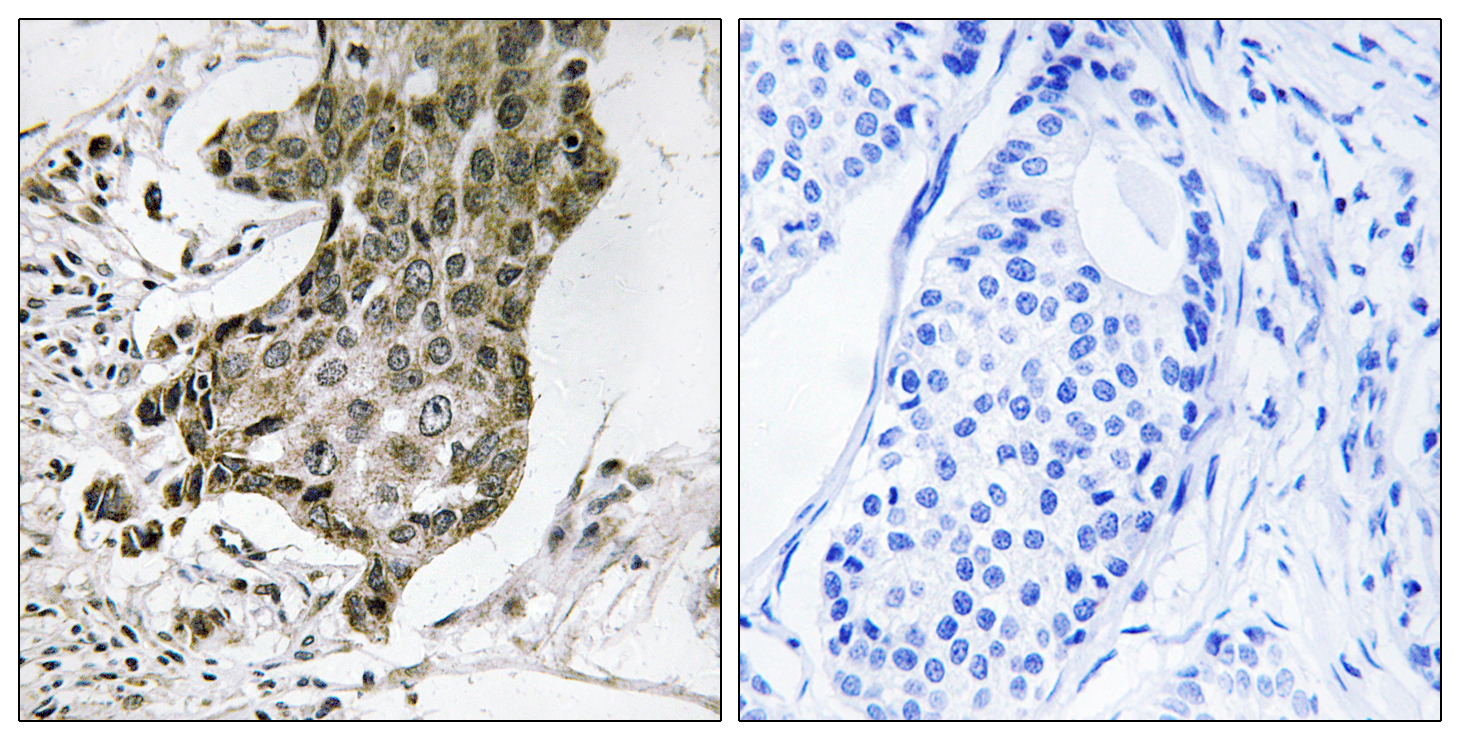 RABEP1 Antibody