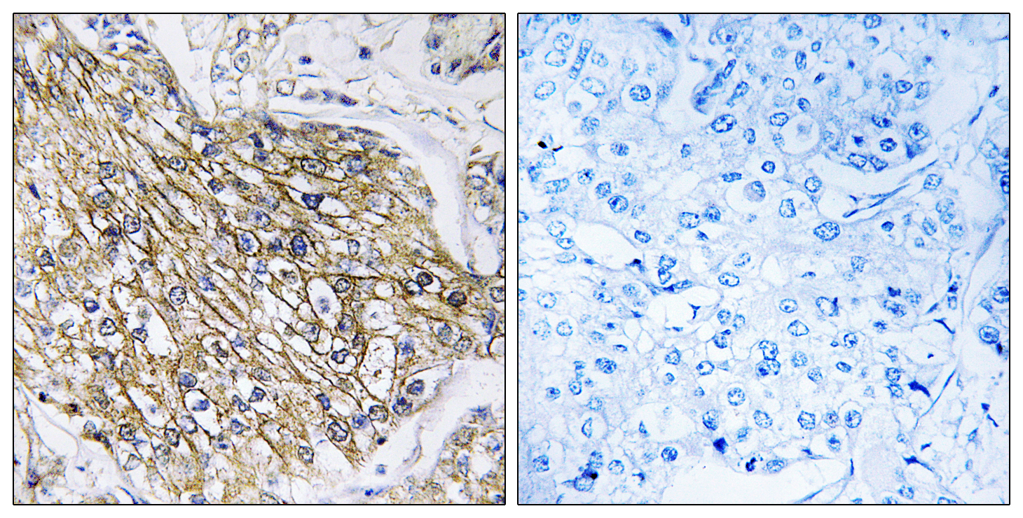 Latrophilin-2 Antibody