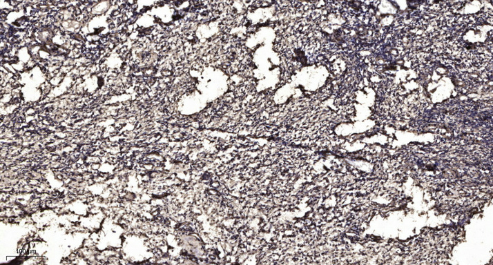 SPTN2 antibody